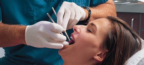 Dental Extractions